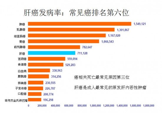 中美肿瘤患者5年生存率差别为何如此大？
