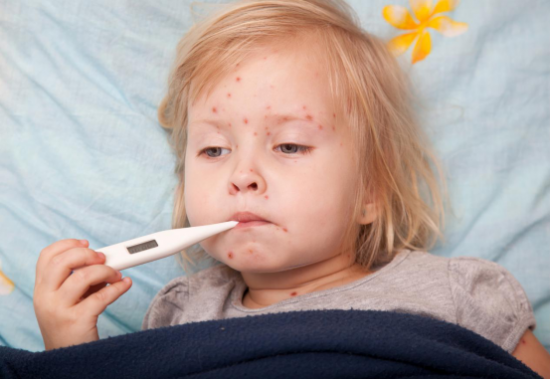 利敏舒益生菌能预防荨麻疹！关于荨麻疹，你还知道多少？