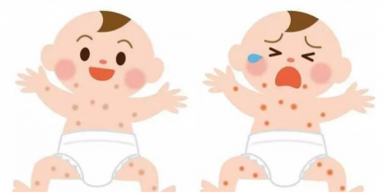 宝宝得了湿疹怎么治？这几点没做对，难怪好不了！