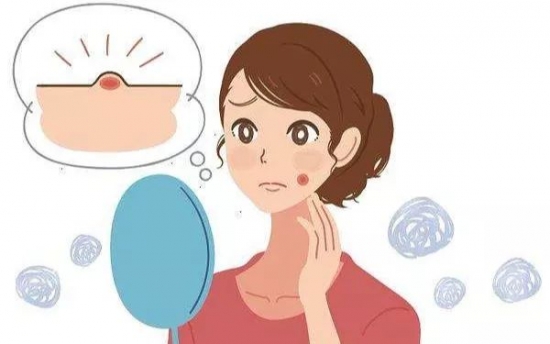 脸上长痘痘怎么办?